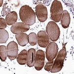 PHLDB1 Antibody in Immunohistochemistry (Paraffin) (IHC (P))