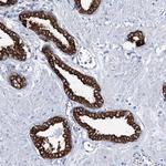 LPHN1 Antibody in Immunohistochemistry (Paraffin) (IHC (P))