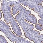 SLC34A2 Antibody in Immunohistochemistry (Paraffin) (IHC (P))