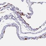 SLC34A2 Antibody in Immunohistochemistry (Paraffin) (IHC (P))