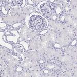 SLC34A2 Antibody in Immunohistochemistry (IHC)