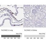 SLC34A2 Antibody