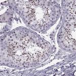 H1FOO Antibody in Immunohistochemistry (IHC)