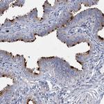 AGBL4 Antibody in Immunohistochemistry (IHC)