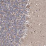 MEPE Antibody in Immunohistochemistry (Paraffin) (IHC (P))