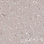 MEPE Antibody in Immunohistochemistry (Paraffin) (IHC (P))