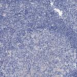 DYDC2 Antibody in Immunohistochemistry (IHC)