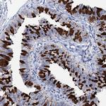 DYDC2 Antibody in Immunohistochemistry (IHC)