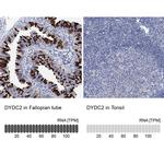 DYDC2 Antibody