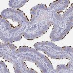 DYDC2 Antibody in Immunohistochemistry (Paraffin) (IHC (P))