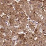 PBLD Antibody in Immunohistochemistry (Paraffin) (IHC (P))