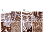 PBLD Antibody in Immunohistochemistry (IHC)