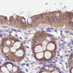 PBLD Antibody in Immunohistochemistry (IHC)