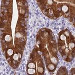 PBLD Antibody in Immunohistochemistry (IHC)