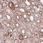 KIF14 Antibody in Immunohistochemistry (Paraffin) (IHC (P))