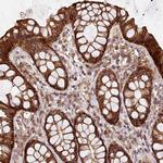 KIF14 Antibody in Immunohistochemistry (Paraffin) (IHC (P))