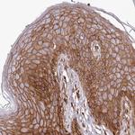 KIF14 Antibody in Immunohistochemistry (Paraffin) (IHC (P))