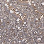 3BP5L Antibody in Immunohistochemistry (Paraffin) (IHC (P))