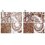 GBE1 Antibody in Immunohistochemistry (IHC)