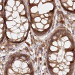 GBE1 Antibody in Immunohistochemistry (IHC)