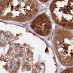 GBE1 Antibody in Immunohistochemistry (IHC)