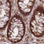 GBE1 Antibody in Immunohistochemistry (IHC)