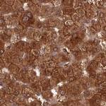 GBE1 Antibody in Immunohistochemistry (IHC)