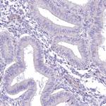 ANGPTL3 Antibody in Immunohistochemistry (Paraffin) (IHC (P))