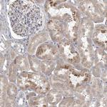 ANGPTL3 Antibody in Immunohistochemistry (Paraffin) (IHC (P))