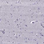 IZUMO1 Antibody in Immunohistochemistry (Paraffin) (IHC (P))