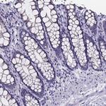 IZUMO1 Antibody in Immunohistochemistry (IHC)