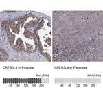 CREB3L4 Antibody in Immunohistochemistry (IHC)