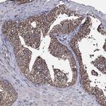 CREB3L4 Antibody in Immunohistochemistry (IHC)