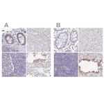 PLCD4 Antibody in Immunohistochemistry (IHC)