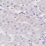 PLCD4 Antibody in Immunohistochemistry (IHC)