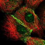 IQSEC1 Antibody in Immunocytochemistry (ICC/IF)