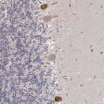 Connexin 31.1 Antibody in Immunohistochemistry (Paraffin) (IHC (P))