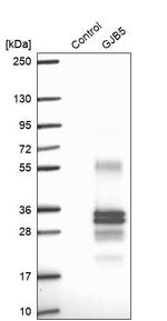 Connexin 31.1 Antibody in Western Blot (WB)