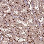 CEP83 Antibody in Immunohistochemistry (Paraffin) (IHC (P))