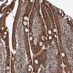 RASSF8 Antibody in Immunohistochemistry (Paraffin) (IHC (P))