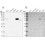 SUOX Antibody in Western Blot (WB)