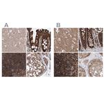 VPS37B Antibody in Immunohistochemistry (IHC)