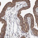 VPS37B Antibody in Immunohistochemistry (IHC)