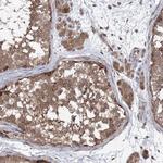 VPS37B Antibody in Immunohistochemistry (IHC)