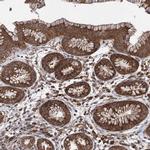 VPS37B Antibody in Immunohistochemistry (IHC)