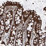 VPS37B Antibody in Immunohistochemistry (IHC)