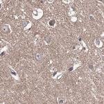 VPS37B Antibody in Immunohistochemistry (IHC)