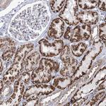 METL5 Antibody in Immunohistochemistry (Paraffin) (IHC (P))