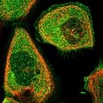 Triadin Antibody in Immunocytochemistry (ICC/IF)