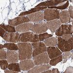 Triadin Antibody in Immunohistochemistry (Paraffin) (IHC (P))